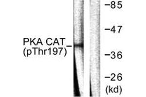 Western blot analysis of extracts from mouse brain, using PKA CAT (Phospho-Thr197) Antibody. (PKA CAT (AA 166-215), (pThr198) anticorps)