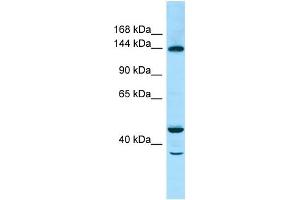 WB Suggested Anti-TBC1D4 Antibody Titration: 1. (TBC1D4 anticorps  (C-Term))