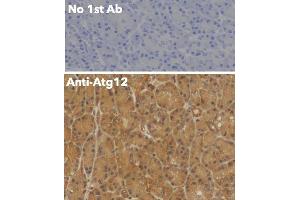 Immunohistochemistry (IHC) image for anti-Autophagy Related 12 (ATG12) (N-Term) antibody (ABIN6254241)