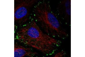 Immunofluorescent staining of HeLa cells with ZYX monoclonal antibody, clone CL2502  (Green) shows distinct focal adhesion. (ZYX anticorps)