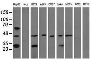 Image no. 2 for anti-Quinolinate Phosphoribosyltransferase (QPRT) antibody (ABIN1500533) (QPRT anticorps)