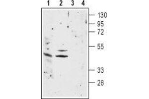 Acetylcholine Receptor Subunit alpha (CHRNA1) peptide