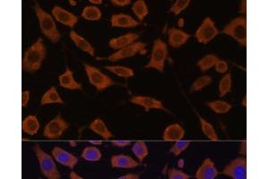 Immunofluorescence analysis of L929 cells using STUB1 Polyclonal Antibody at dilution of 1:100 (40x lens). (STUB1 anticorps)