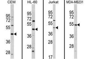 Western blot analysis of PTAR1 Antibody (Center) from left to right in CEM, HL-60, Jurkat, MDA-MB231 cell line lysates (35ug/lane). (PTAR1 anticorps  (Middle Region))