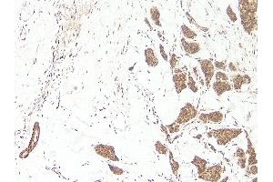 Immunohistochemistry (IHC) image for anti-Wingless-Type MMTV Integration Site Family, Member 3A (WNT3A) (N-Term) antibody (Biotin) (ABIN2477145)