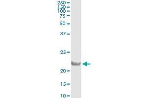 Immunoprecipitation of COMMD1 transfected lysate using anti-COMMD1 monoclonal antibody and Protein A Magnetic Bead , and immunoblotted with COMMD1 MaxPab rabbit polyclonal antibody.