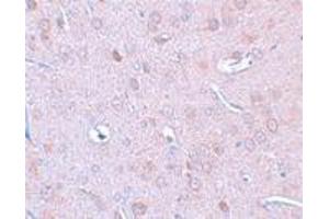Immunohistochemistry (IHC) image for anti-Doublecortin-Like Kinase 1 (DCLK1) (N-Term) antibody (ABIN1031345)