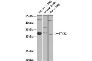 Western blot analysis of extracts of various cell lines, using STX12 antibody (ABIN6128798, ABIN6148655, ABIN6148656 and ABIN6224224) at 1:1000 dilution. (Syntaxin 12 anticorps  (AA 1-250))