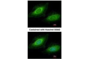 ICC/IF Image Immunofluorescence analysis of methanol-fixed HeLa, using TSSC1, antibody at 1:200 dilution. (TSSC1 anticorps  (Center))