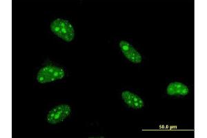 Immunofluorescence of monoclonal antibody to ZFHX3 on HeLa cell. (ZFHX3 anticorps  (AA 2811-2910))