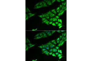 Immunofluorescence analysis of U2OS cells using PSAT1 antibody. (PSAT1 anticorps  (AA 1-370))