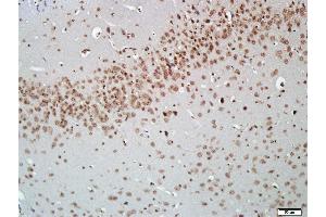 Paraformaldehyde-fixed, paraffin embedded Mouse brain, Antigen retrieval by boiling in sodium citrate buffer (pH6.