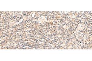 Immunohistochemistry of paraffin-embedded Human tonsil tissue using TRAPPC1 Polyclonal Antibody at dilution of 1:50(x200) (TRAPPC1 anticorps)