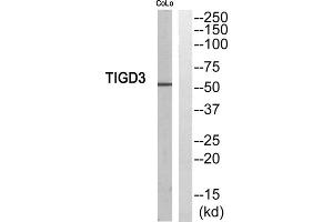 Western blot analysis of extracts from COLO205 cells, using TIGD3 antibody. (TIGD3 anticorps  (C-Term))