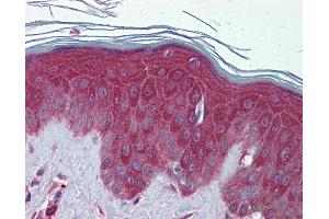 Immunohistochemistry (IHC) image for anti-Peroxiredoxin 6 (PRDX6) (C-Term) antibody (ABIN2783305)