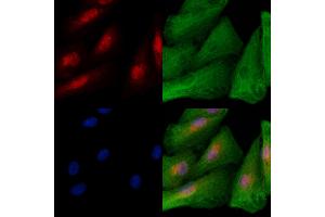 ABIN6258869 and ABIN6273723 staining  cells by IF/ICC.