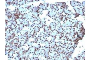 Formalin-fixed, paraffin-embedded rat pancreas stained with SUMO-1 antibody (SUMO1/1188) (SUMO1 anticorps)