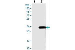 Western blot analysis of Lane 1: Negative control (vector only transfected HEK293T lysate), Lane 2: Over-expression Lysate (Co-expressed with a C-terminal myc-DDK tag (~3. (SLC25A10 anticorps)