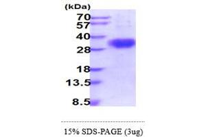 SDS-PAGE (SDS) image for Fc Fragment of IgG, Low Affinity IIIb, Receptor (CD16b) (FCGR3B) (AA 21-200) protein (His tag) (ABIN5855003)