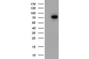 Western Blotting (WB) image for anti-SAM Domain and HD Domain 1 (SAMHD1) antibody (ABIN1500800) (SAMHD1 anticorps)