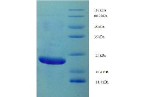 SDS-PAGE (SDS) image for Alopecia, Androgenetic, 2 (AGA2) (AA 19-87) protein (His-SUMO Tag) (ABIN5710900) (AGA2 Protein (AA 19-87) (His-SUMO Tag))