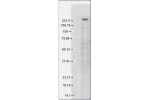 Western Blotting (WB) image for anti-Transient Receptor Potential Cation Channel, Subfamily M, Member 7 (TRPM7) (AA 1817-1863), (C-Term) antibody (ABIN452417) (TRPM7 anticorps  (C-Term))