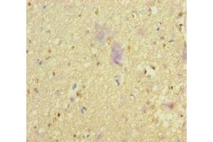 Immunohistochemistry of paraffin-embedded human brain tissue using ABIN7161659 at dilution of 1:100 (NMDA Receptor Synaptonuclear Signaling and Neuronal Migration Factor (NSMF) (AA 251-530) anticorps)