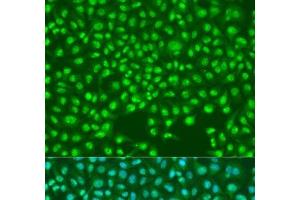 Immunofluorescence analysis of U2OS cells using SKP2 Polyclonal Antibody at dilution of 1:100. (SKP2 anticorps)
