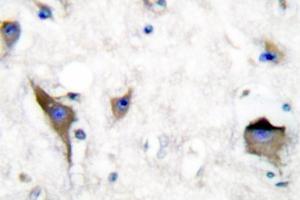 Image no. 1 for anti-PTK2B Protein tyrosine Kinase 2 beta (PTK2B) antibody (ABIN271797) (PTK2B anticorps)