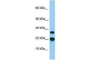 Host: Rabbit Target Name: BTF3L4 Sample Type: MCF7 Whole Cell lysates Antibody Dilution: 1. (BTF3L4 anticorps  (C-Term))