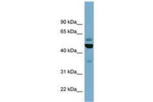 Image no. 1 for anti-Tubulin, epsilon 1 (TUBE1) (C-Term) antibody (ABIN6741994) (TUBE1 anticorps  (C-Term))