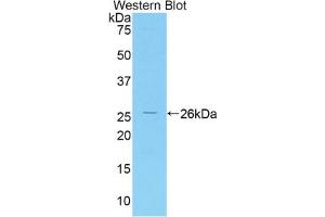 Western blot analysis of the recombinant protein. (IRAK3 anticorps  (AA 201-410))