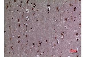 Immunohistochemistry (IHC) analysis of paraffin-embedded Human Brain, antibody was diluted at 1:100.