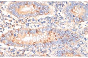Immunohistochemistry of paraffin-embedded Human appendix using WNK3 Polyclonal Antibody at dilution of 1:100 (40x lens). (WNK3 anticorps)