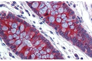 Immunohistochemistry with Human Colon lysate tissue at an antibody concentration of 5.