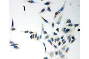 ICC testing of NOX5 antibody and HeLa cells (NOX5 anticorps  (C-Term))