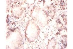 Immunohistochemistry of paraffin-embedded human prostate tissue using ABIN7152800 at dilution of 1:100 (FGF2 anticorps  (AA 143-288))