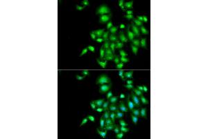 anti-Interleukin 20 (IL20) (AA 25-176) antibody