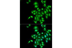 Immunofluorescence analysis of  cells using IL20 antibody (ABIN6128133, ABIN6142353, ABIN6142354 and ABIN6222322). (IL-20 anticorps  (AA 25-176))