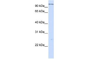 DHX15 antibody used at 1 ug/ml to detect target protein.