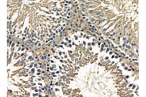 ABIN7095399 and ABIN7099456 at 1/100 staining rat testis tissue by IHC-P.
