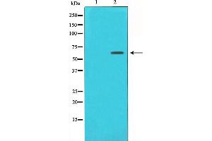 Western blot analysis of Estrogen Receptor-alpha expression in 293 whole cell lysates,The lane on the left is treated with the antigen-specific peptide. (Estrogen Receptor alpha anticorps  (C-Term))