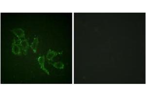 Immunofluorescence analysis of HepG2 cells, using A-RAF (Phospho-Tyr302) Antibody.