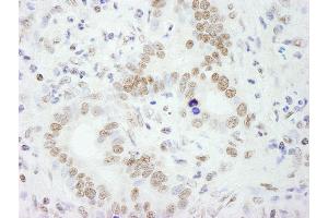 Immunohistochemistry (IHC) image for anti-Splicing Factor Proline/glutamine-Ric (SFPQ) (AA 1-50) antibody (ABIN7453760)