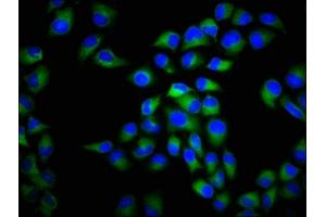 Immunofluorescence staining of Hela cells with ABIN7175586 at 1:266, counter-stained with DAPI.