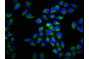 Immunofluorescence staining of Hela cells with ABIN7175586 at 1:266, counter-stained with DAPI. (CACNA1C anticorps  (AA 1755-1971))