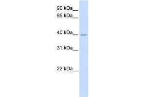 SRD5A3 antibody used at 1 ug/ml to detect target protein. (SRD5A3 anticorps  (N-Term))
