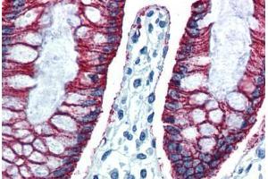 Human Colon (formalin-fixed, paraffin-embedded) stained with CLDN7 antibody ABIN364312 at 10 ug/ml followed by biotinylated anti-mouse IgG secondary antibody ABIN481714, alkaline phosphatase-streptavidin and chromogen.
