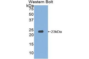Western blot analysis of the recombinant protein. (SIT1 anticorps  (AA 2-175))