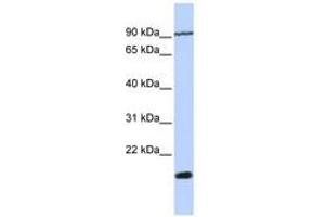 Image no. 1 for anti-Transmembrane 4 Superfamily Member 4 (TM4SF4) (N-Term) antibody (ABIN6740976)